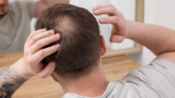 Effective Methods for Balding Crown: Natural and Evidence-Based Solutions